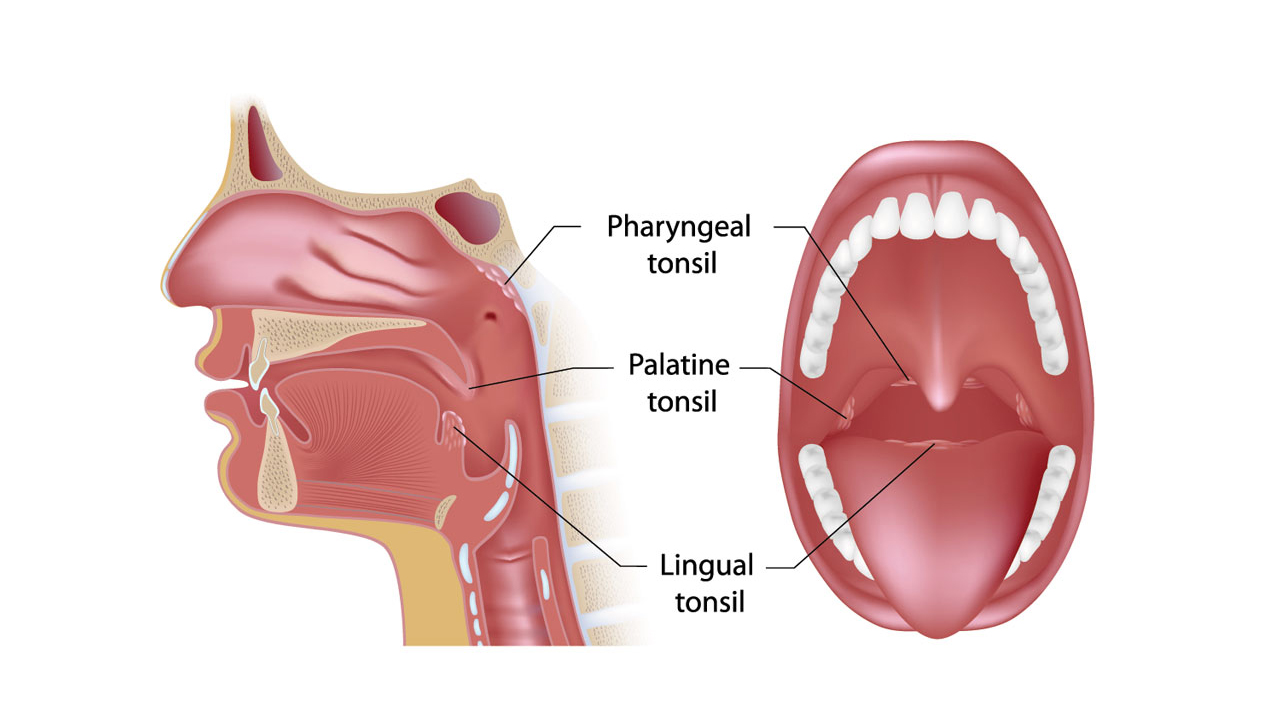 Lingual Tonsiller