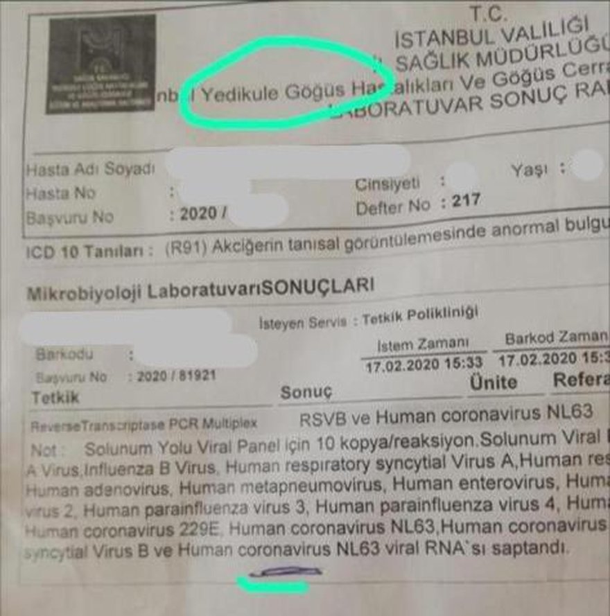 Sağlık Bakanı Fahrettin Koca, İstanbul’da Görülen Corona Virüsü Hakkında Açıklama Yaptı