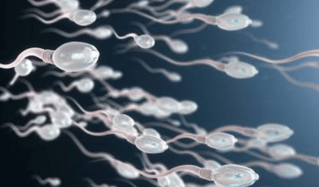 Sperm