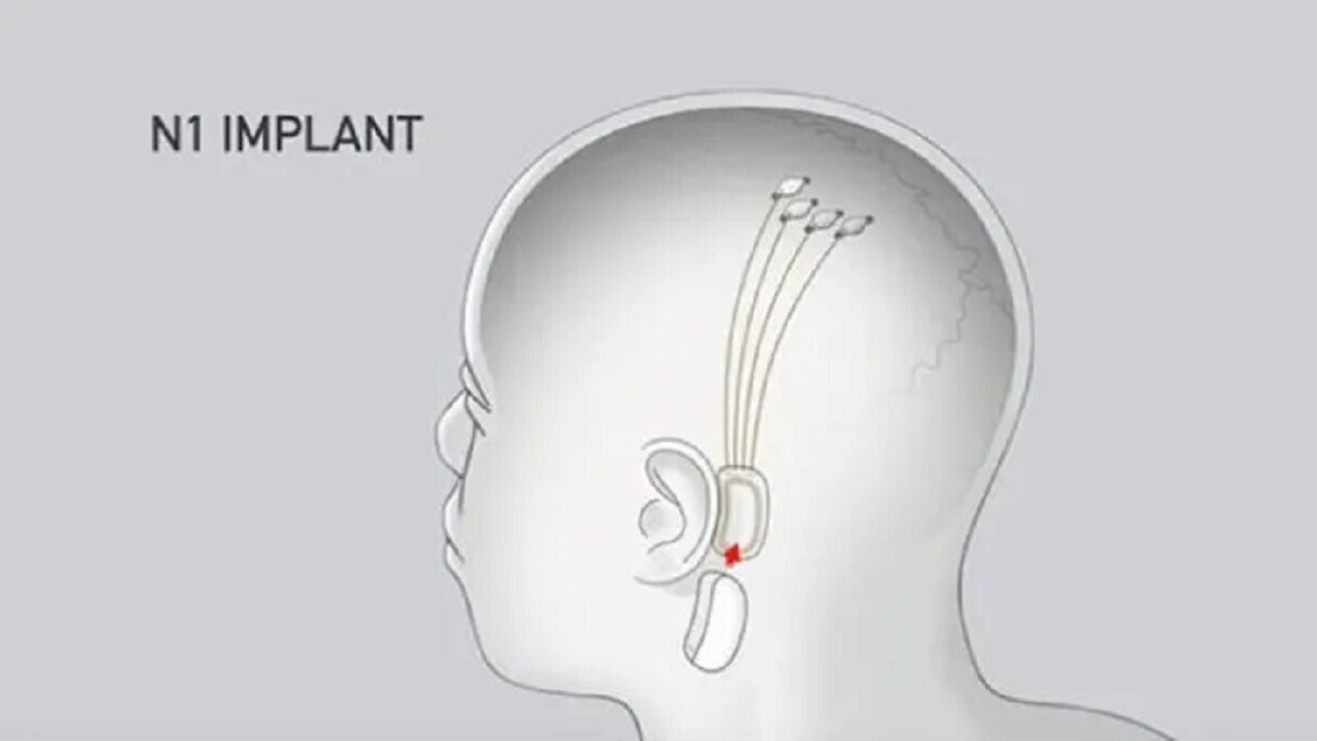 neuralink