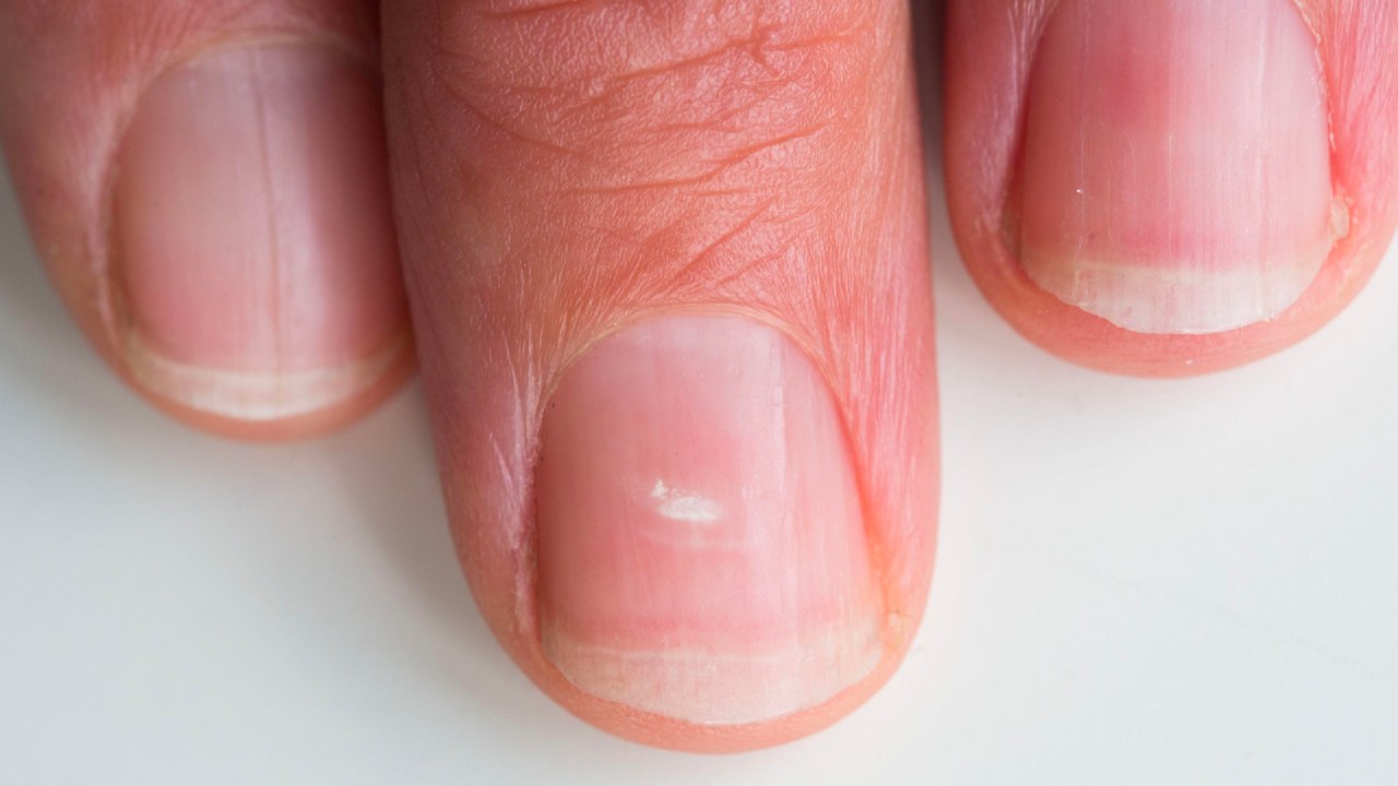 nail whiteness