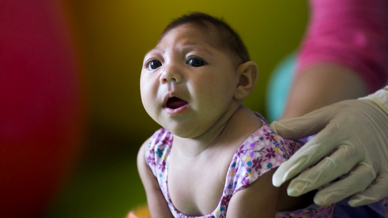 a patient with microcephaly