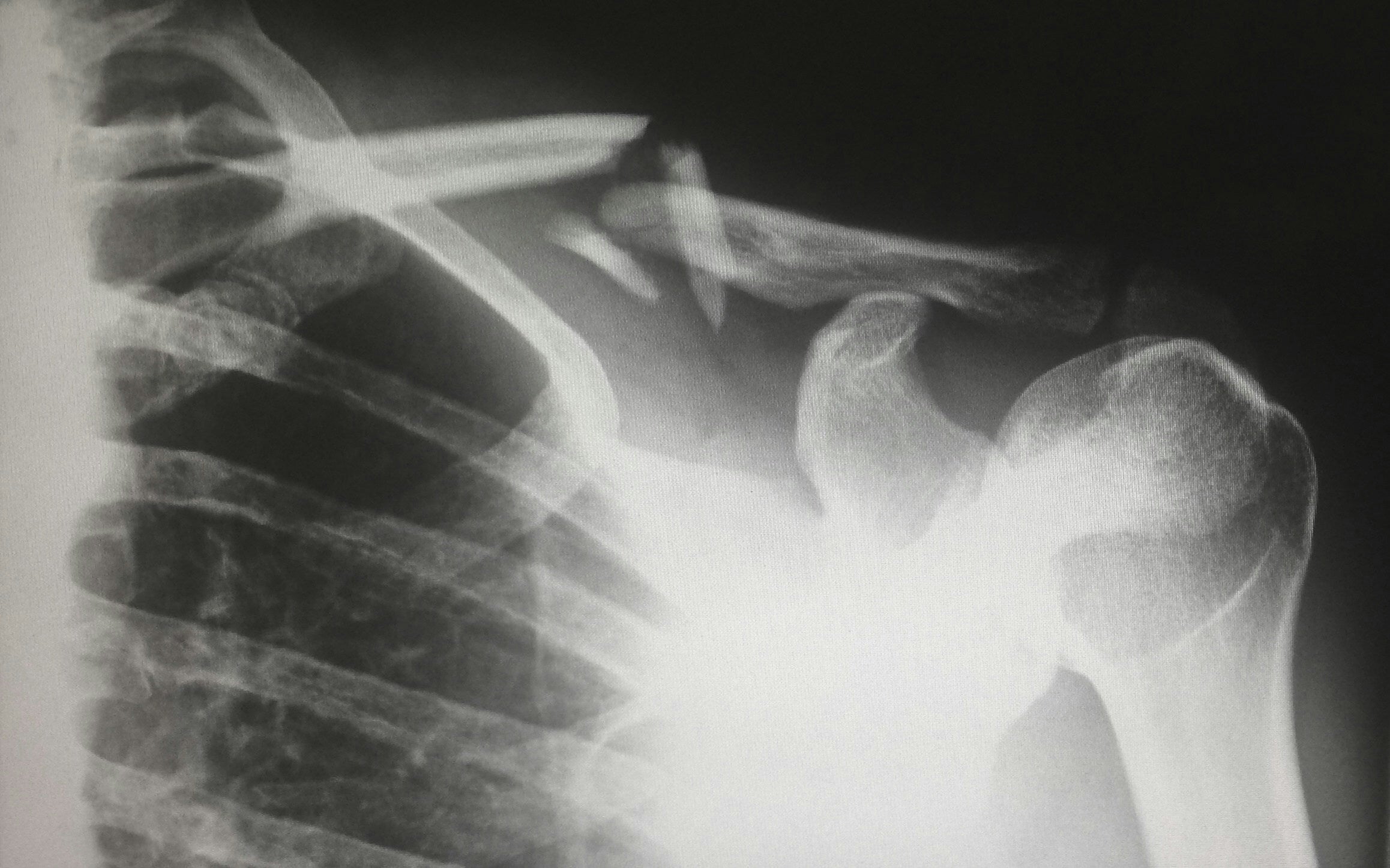 Akıllı Telefonlar Yakında Röntgen Çekmeye Başlayabilir (Bir Şeker Ölçmeyi Çözemediniz)