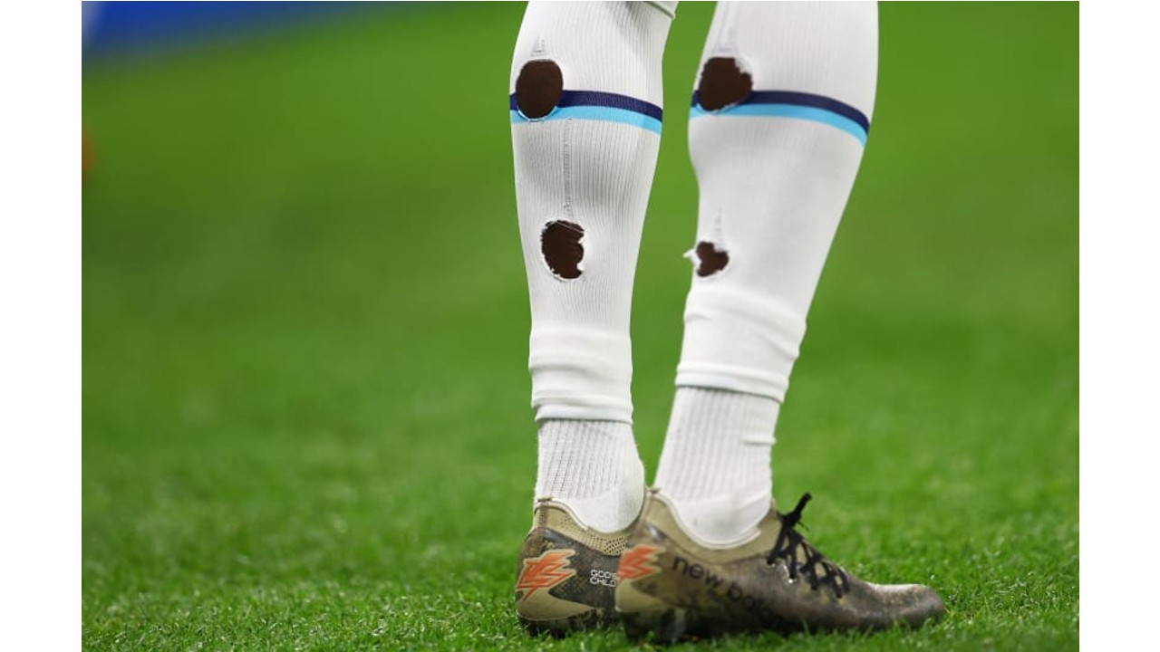 Why are football players' socks torn?