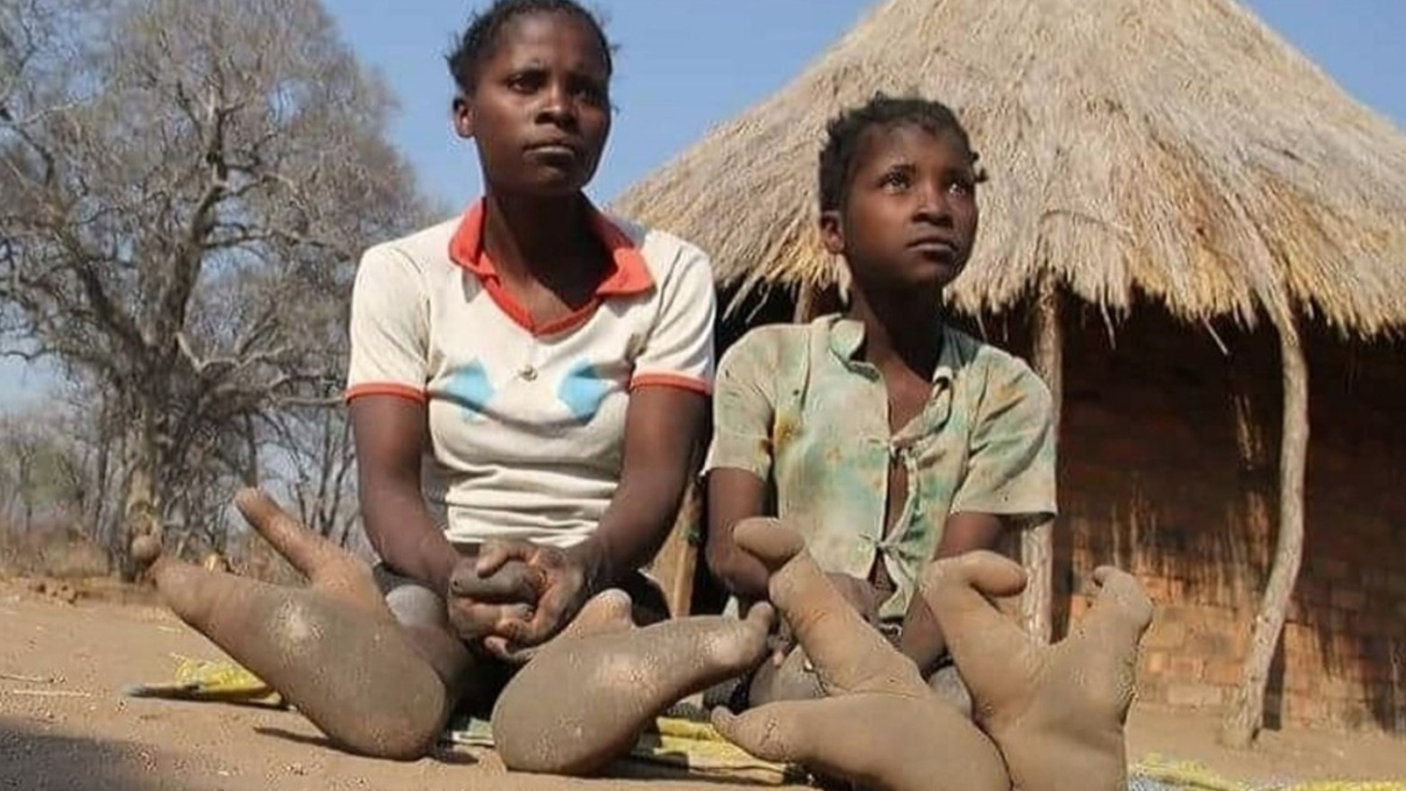 Afrika Kabilesindeki Bu İnsanların Neden Devekuşu Gibi 2 Parmaklı Ayakları Var?